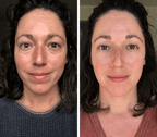 Jade roler i gua sha SET (self-care)
